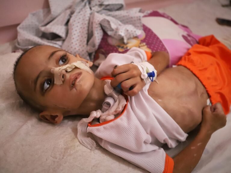 Gaza toddler with shrapnel in brain fights for life after family killed | Israel-Palestine conflict News